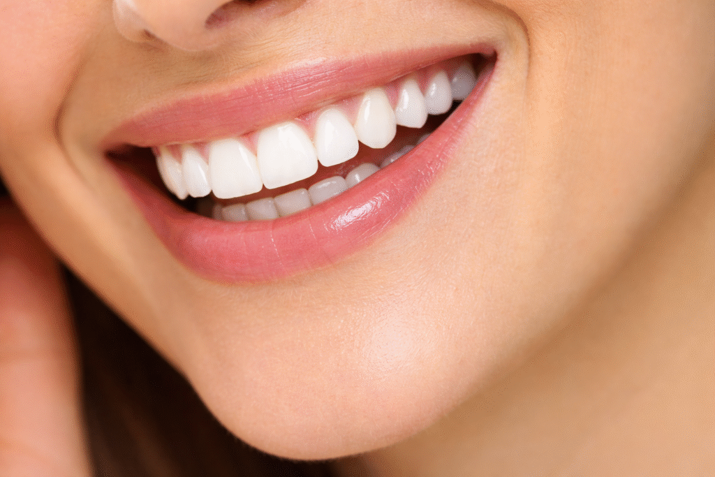 Clareamento Caseiro ou a Laser Qual Melhor (2) Clareamento Caseiro ou a Laser Qual Melhor